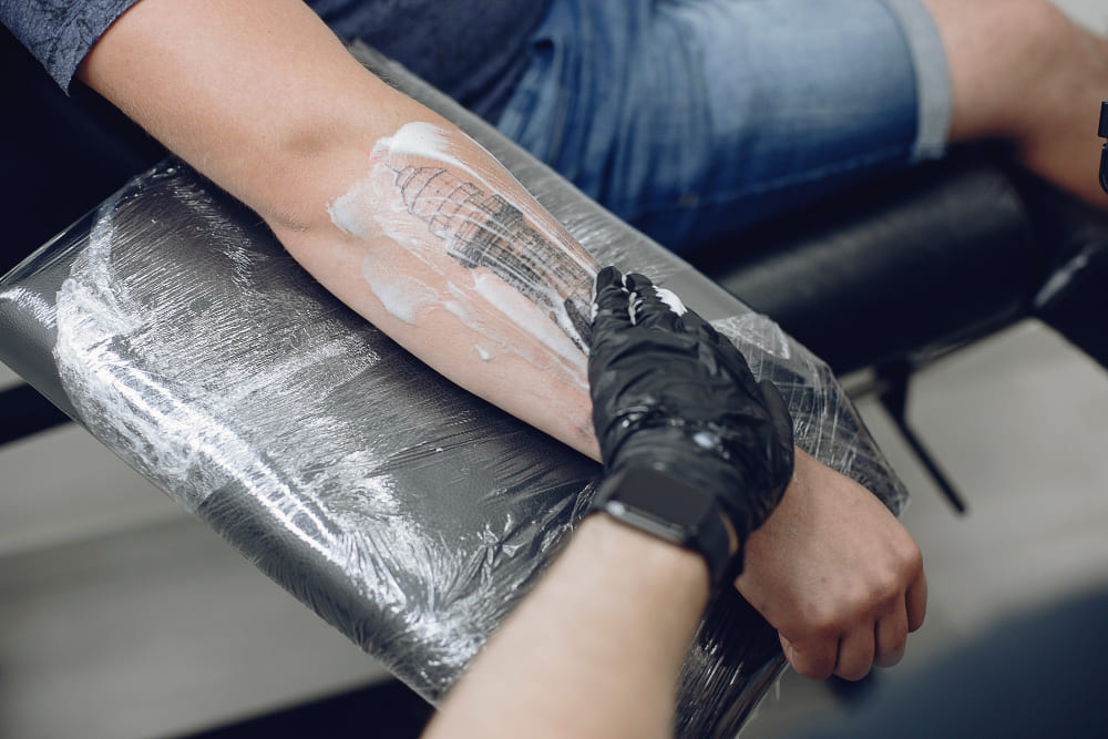 Laser Tattoo Removal