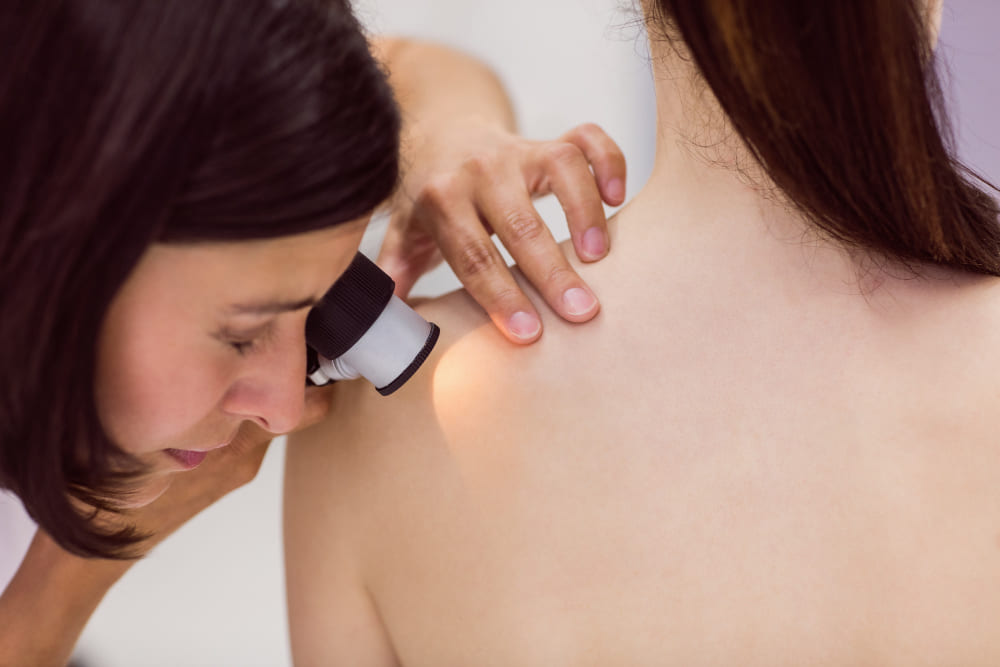 Mole / Wart / Skin Tag Removal