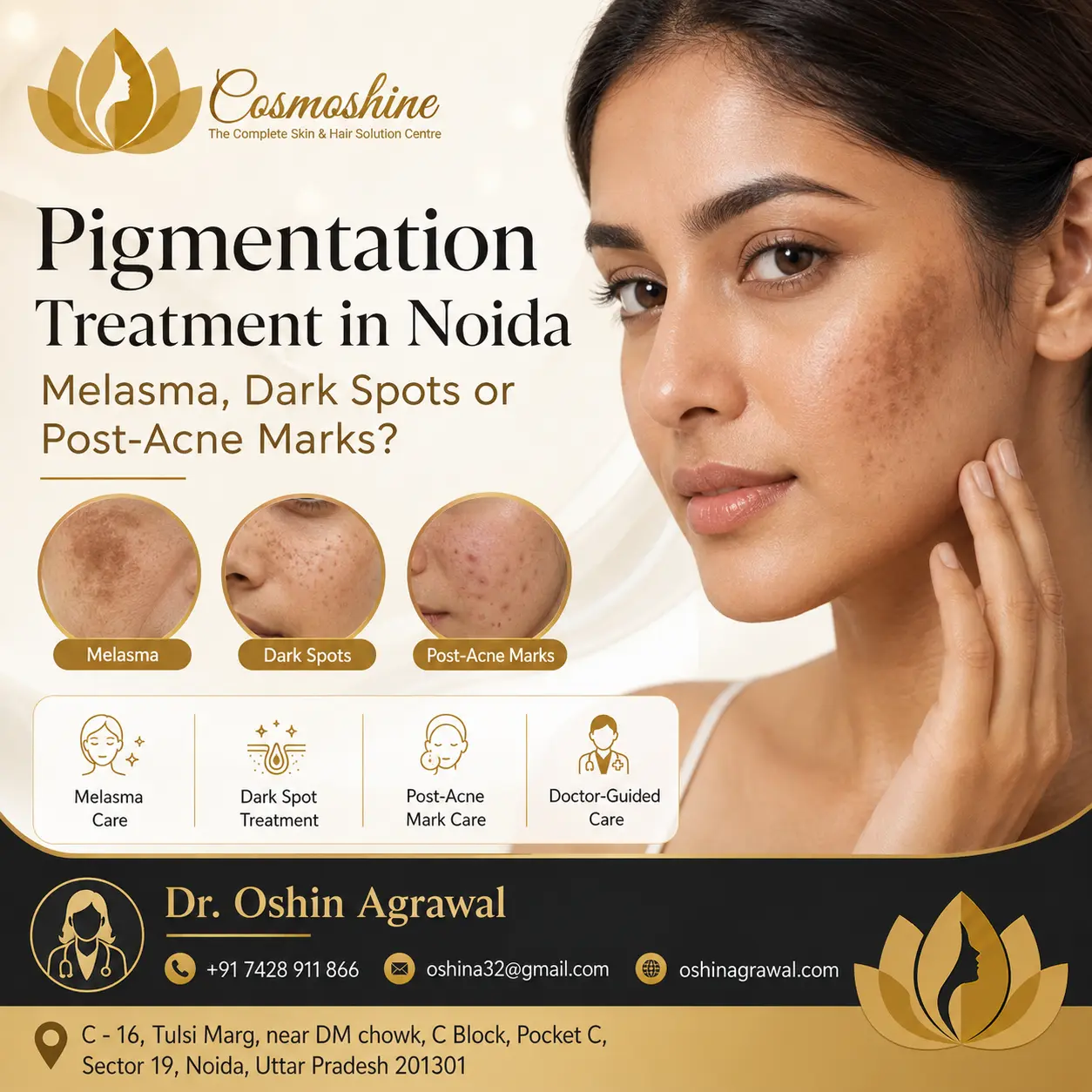 Pigmentation treatment in Noida