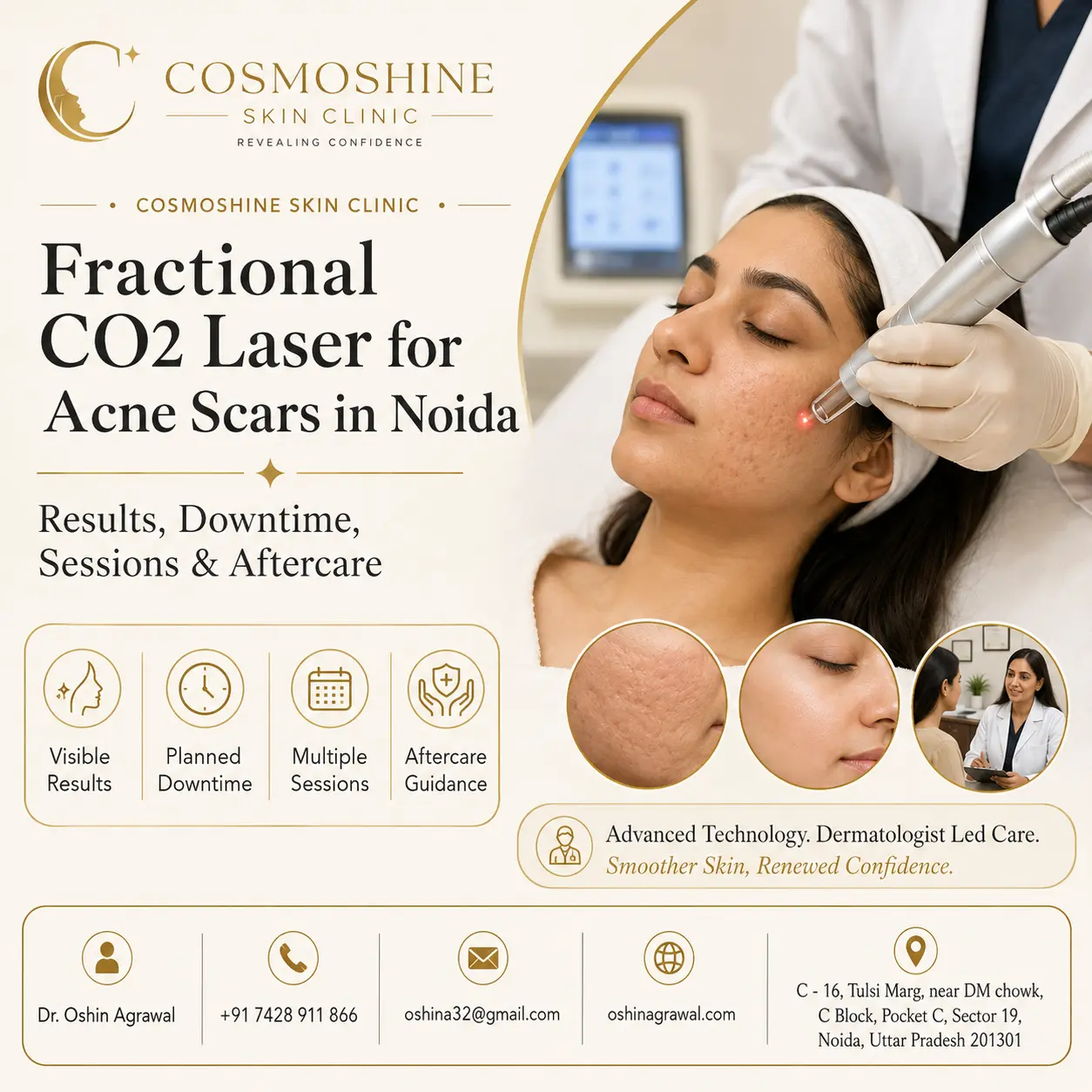 CO2 laser treatment in Noida