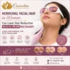 laser hair removal for PCOS facial hair
